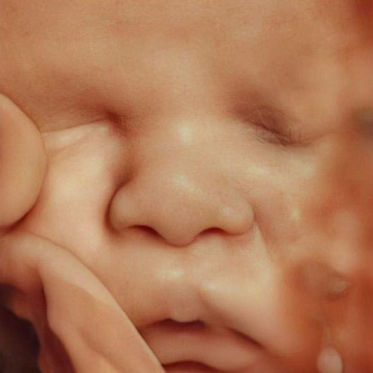 Ultrassonografia 3d 4d Fertilivita Reproducao Humana